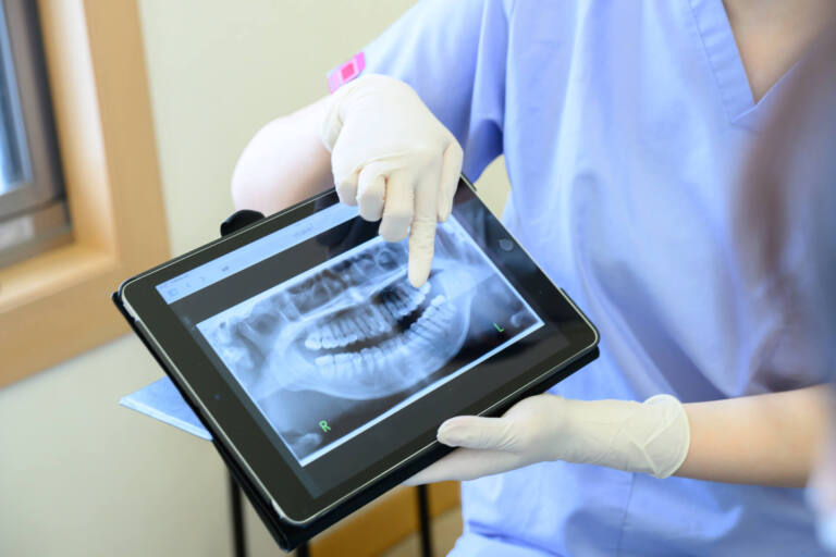 治療計画の策定