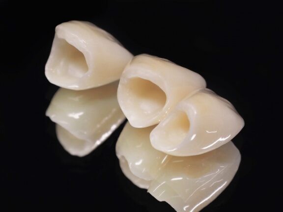 審美歯科治療：セラミック