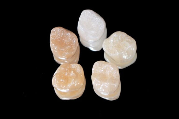 審美歯科治療：ジルコニア