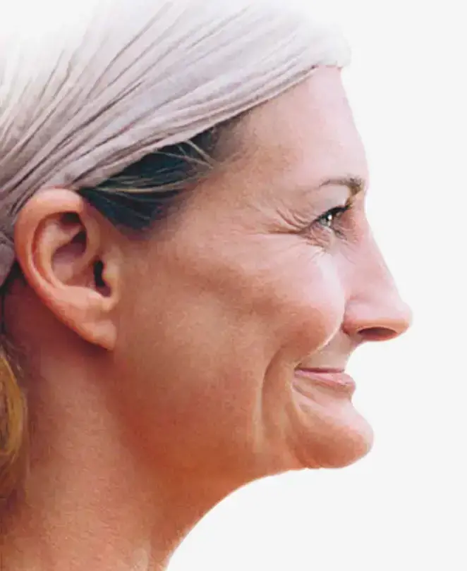 骨がないと[After]